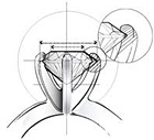 Prong Setting Types